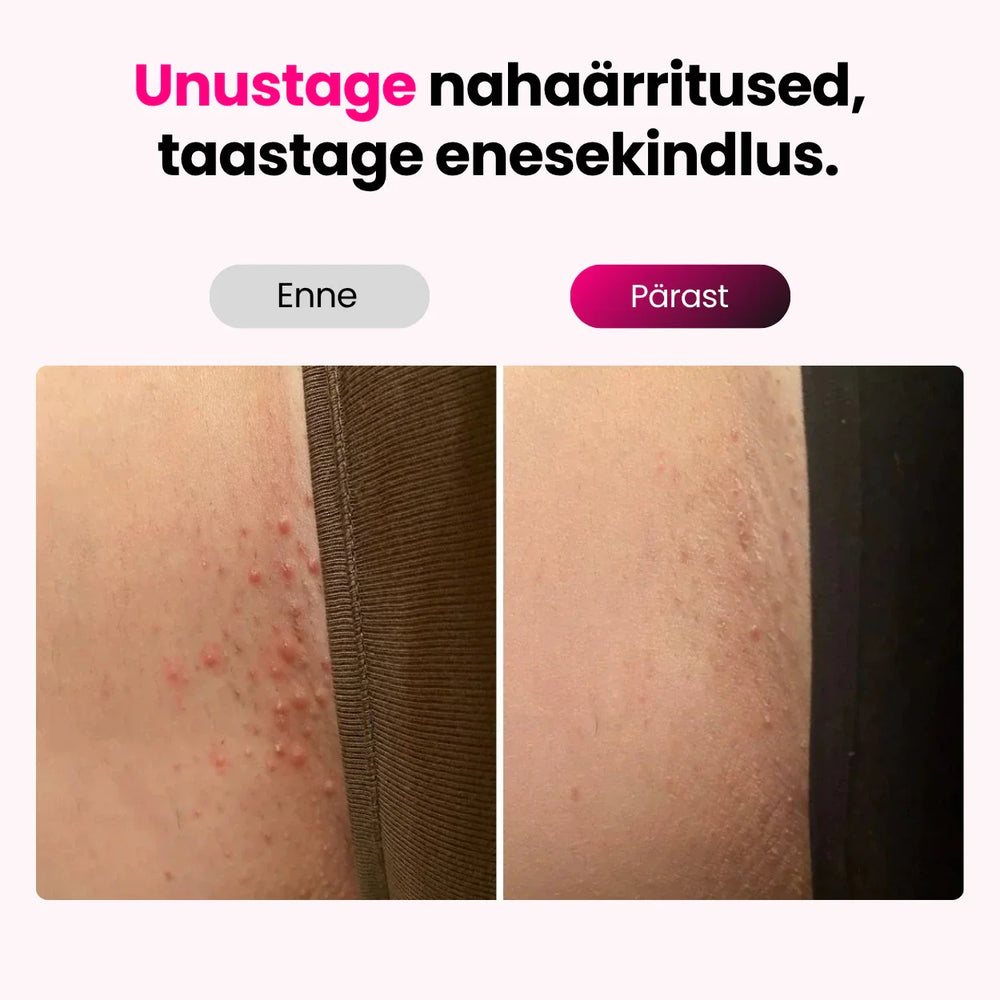 Elumi™ IPL-fotoepilaatori komplekt