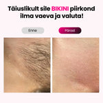 Elumi™ IPL-fotoepilaatori komplekt